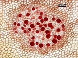8 - Dettaglio di un soro di tetrasporocisti